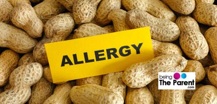 Peanut allergy peanuts infants feeding analyses