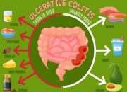 Colitis ulcerosa Ernährung Kinder Tipps & Tricks