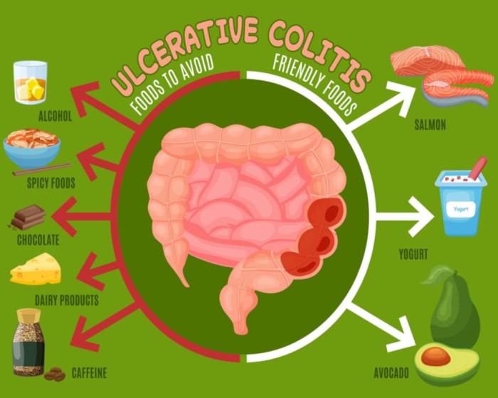 Colitis ulcerosa ernährung kinder